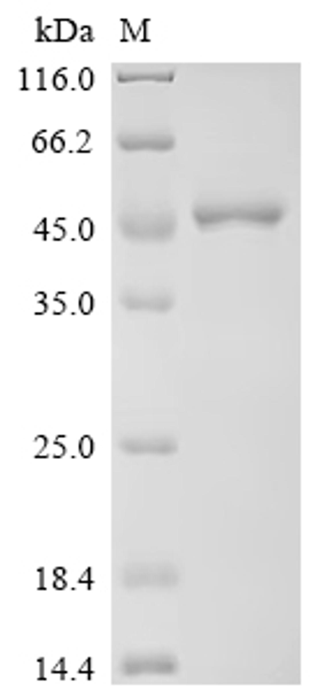 (Tris-Glycine gel) Discontinuous SDS-PAGE (reduced) with 5% enrichment gel and 15% separation gel.