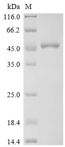 (Tris-Glycine gel) Discontinuous SDS-PAGE (reduced) with 5% enrichment gel and 15% separation gel.