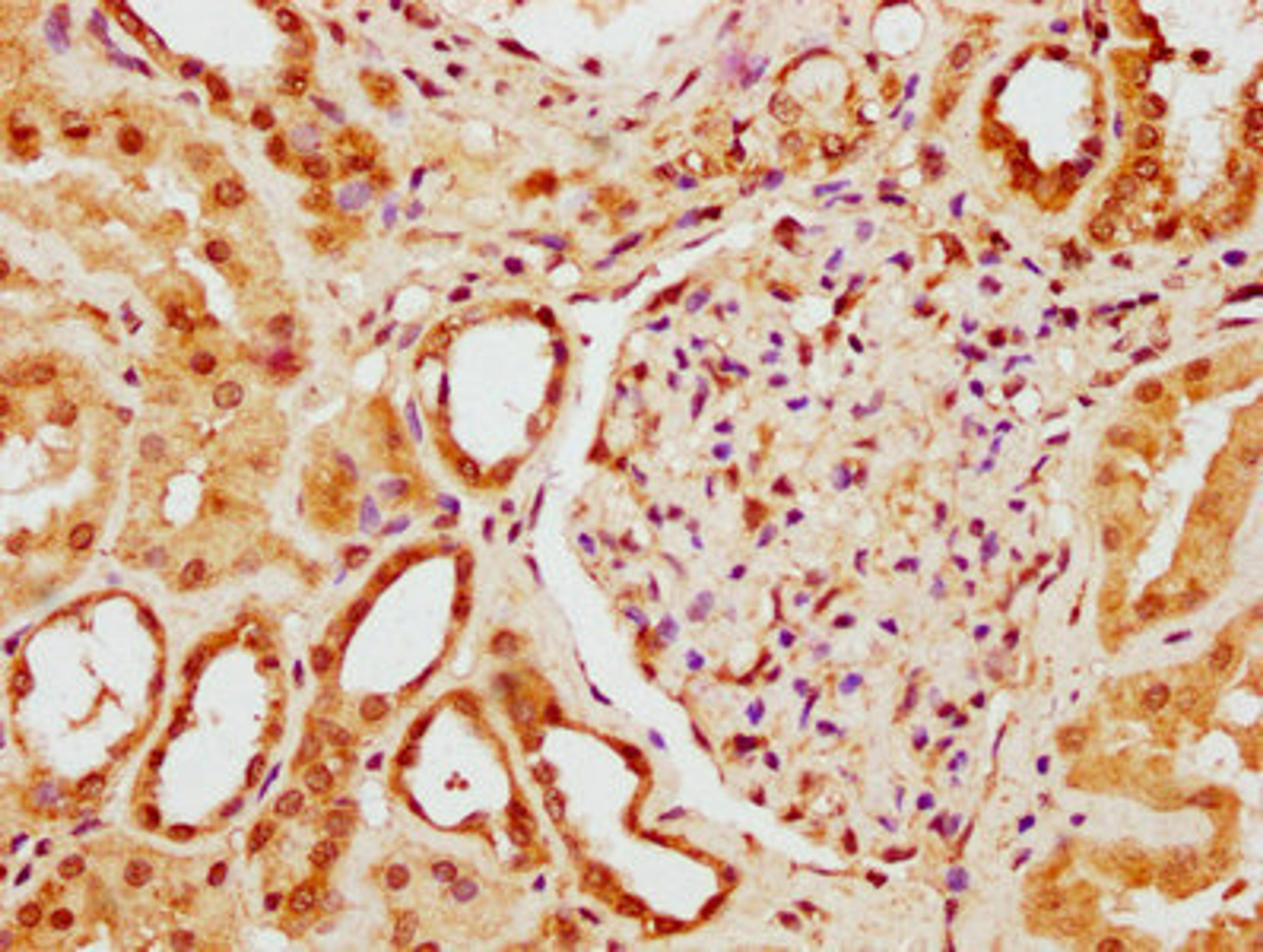 IHC image of CSB-PA884488LA01HU diluted at 1:300 and staining in paraffin-embedded human kidney tissue performed on a Leica BondTM system. After dewaxing and hydration, antigen retrieval was mediated by high pressure in a citrate buffer&nbsp;(pH 6.0). Section was blocked with 10% normal goat serum 30min at RT. Then primary antibody&nbsp;(1% BSA) was incubated at 4&deg;C overnight. The primary is detected by a biotinylated secondary antibody and visualized using an HRP conjugated SP system.