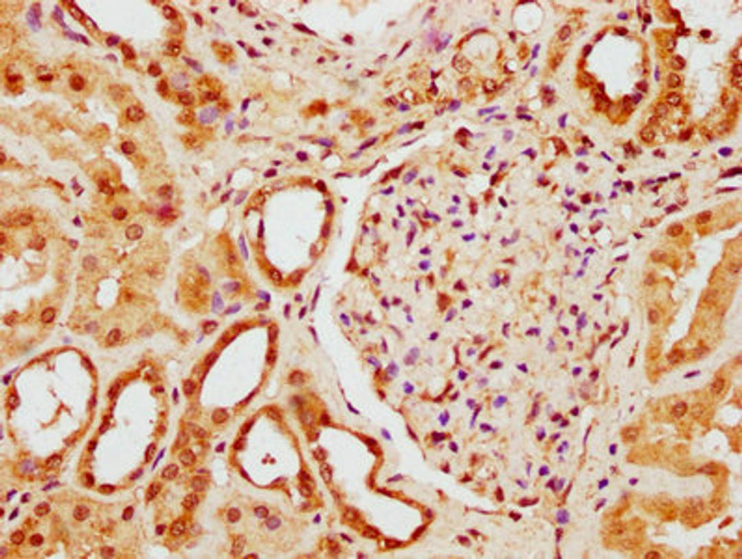 IHC image of CSB-PA884488LA01HU diluted at 1:300 and staining in paraffin-embedded human kidney tissue performed on a Leica BondTM system. After dewaxing and hydration, antigen retrieval was mediated by high pressure in a citrate buffer (pH 6.0). Section was blocked with 10% normal goat serum 30min at RT. Then primary antibody (1% BSA) was incubated at 4°C overnight. The primary is detected by a biotinylated secondary antibody and visualized using an HRP conjugated SP system.