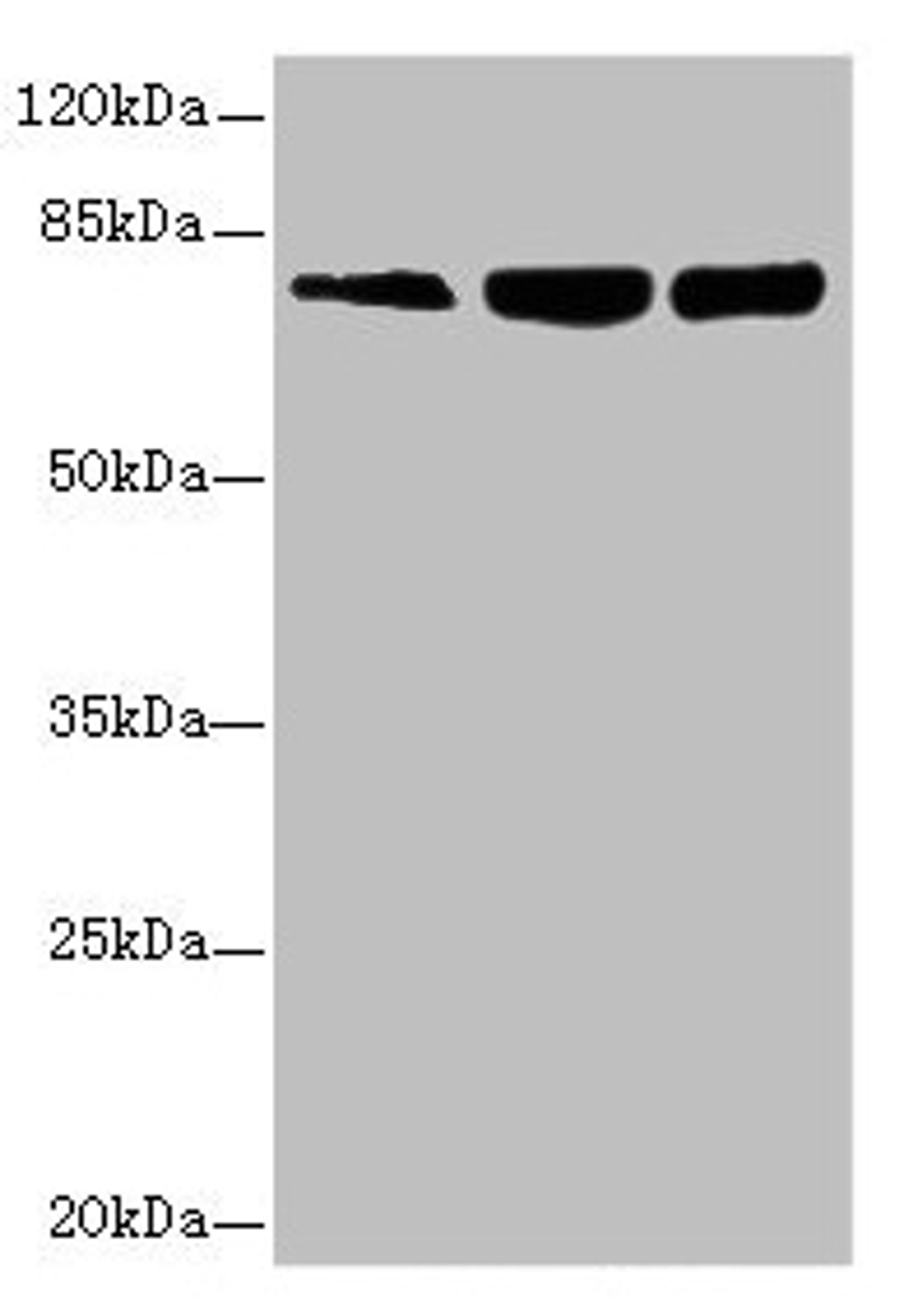 Western blot. All lanes: GMPS antibody at 2.69µg/ml. Lane 1: Hela whole cell lysate. Lane 2: HL60 whole cell lysate. Lane 3: MCF-7 whole cell lysate. Secondary. Goat polyclonal to Rabbit IgG at 1/10000 dilution. Predicted band size: 77, 66 kDa. Observed band size: 77 kDa