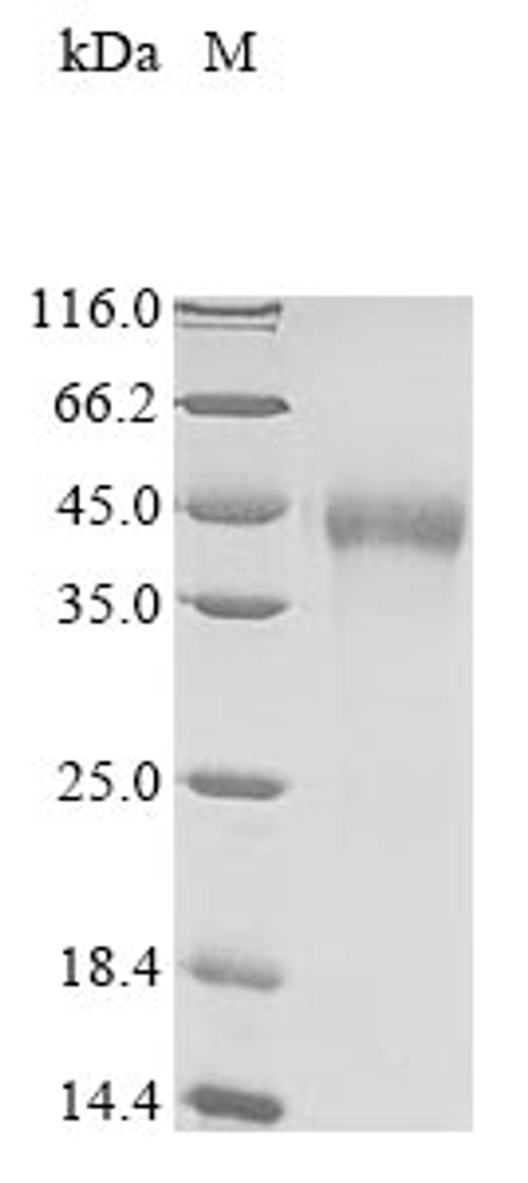 (Tris-Glycine gel) Discontinuous SDS-PAGE (reduced) with 5% enrichment gel and 15% separation gel.
