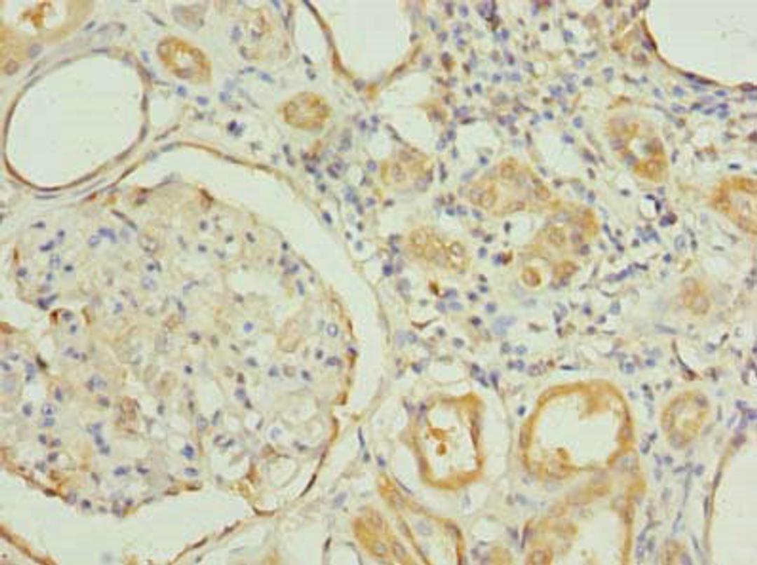 Immunohistochemistry of paraffin-embedded human kidney tissue using CSB-PA856927LA01HU at dilution of 1:100
