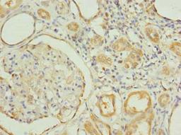 Immunohistochemistry of paraffin-embedded human kidney tissue using CSB-PA856927LA01HU at dilution of 1:100