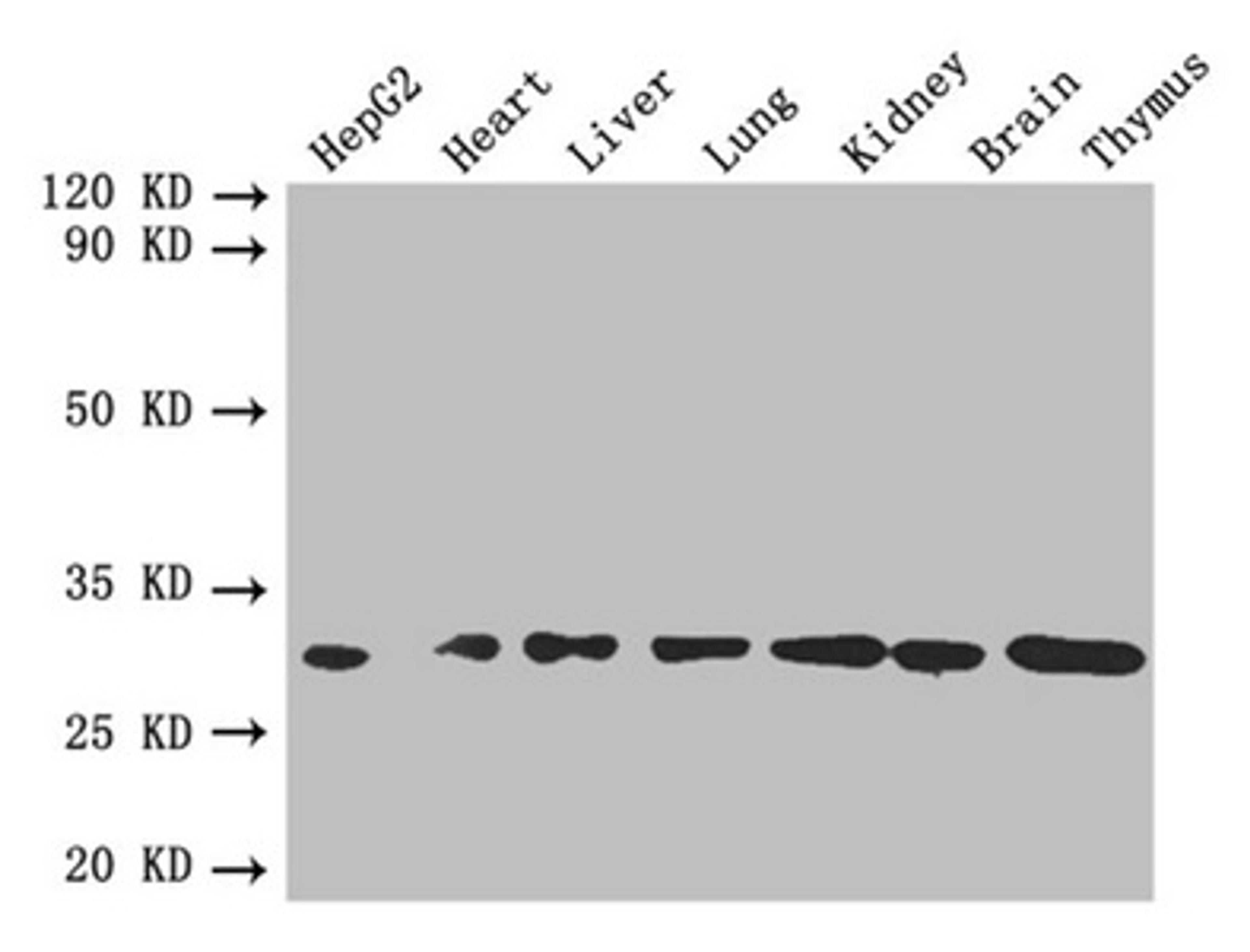 Western blot. All lanes: FGF2 antibody at 4µg/ml. Lane 1: HepG2 whole cell lysate. Lane 2: Mouse heart tissue. Lane 3: Mouse liver tissue. Lane 4: Mouse lung tissue. Lane 5: Mouse kidney tissue. Lane 6: Mouse brain tissue. Lane 7: Mouse thymus tissue. Secondary. Goat polyclonal to rabbit IgG at 1/10000 dilution. Predicted band size: 31, 23, 18, 22 kDa. Observed band size: 31 kDa