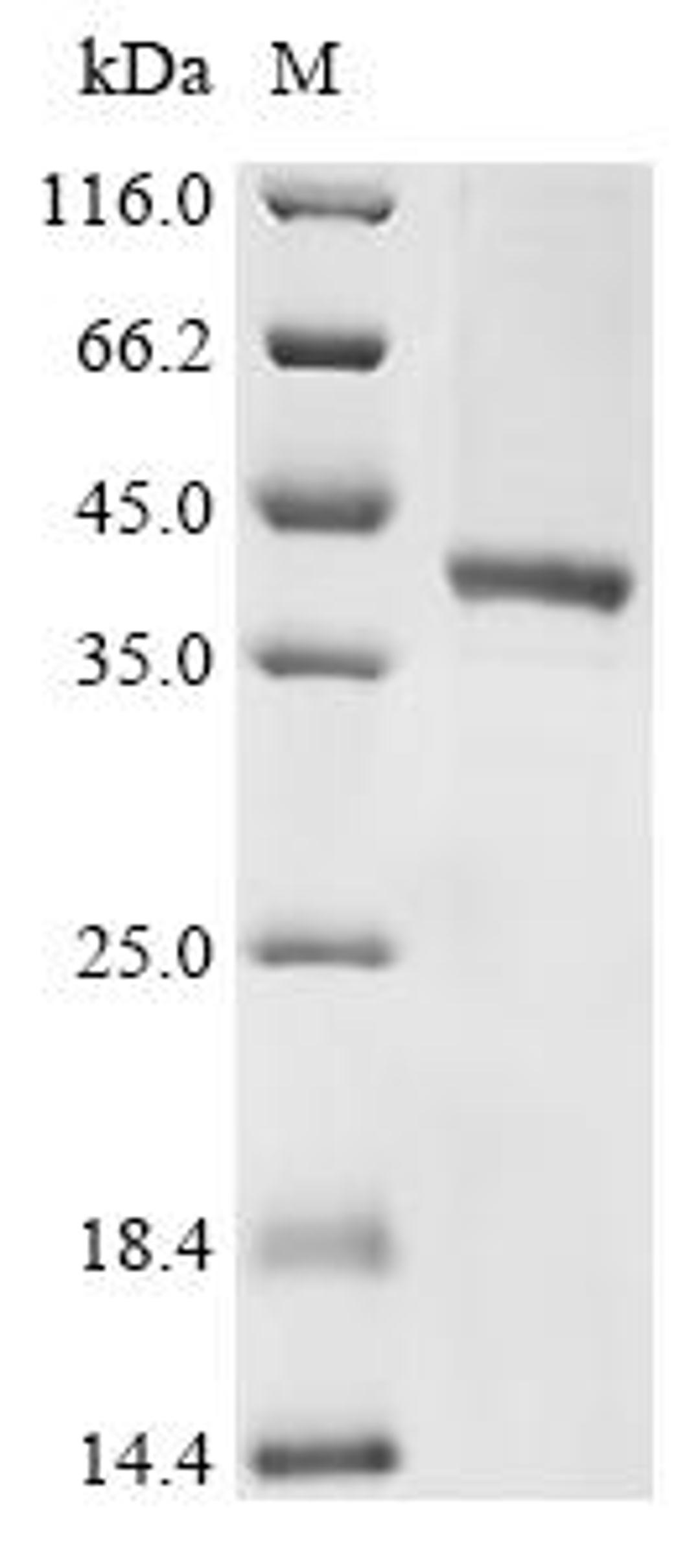 (Tris-Glycine gel) Discontinuous SDS-PAGE (reduced) with 5% enrichment gel and 15% separation gel.