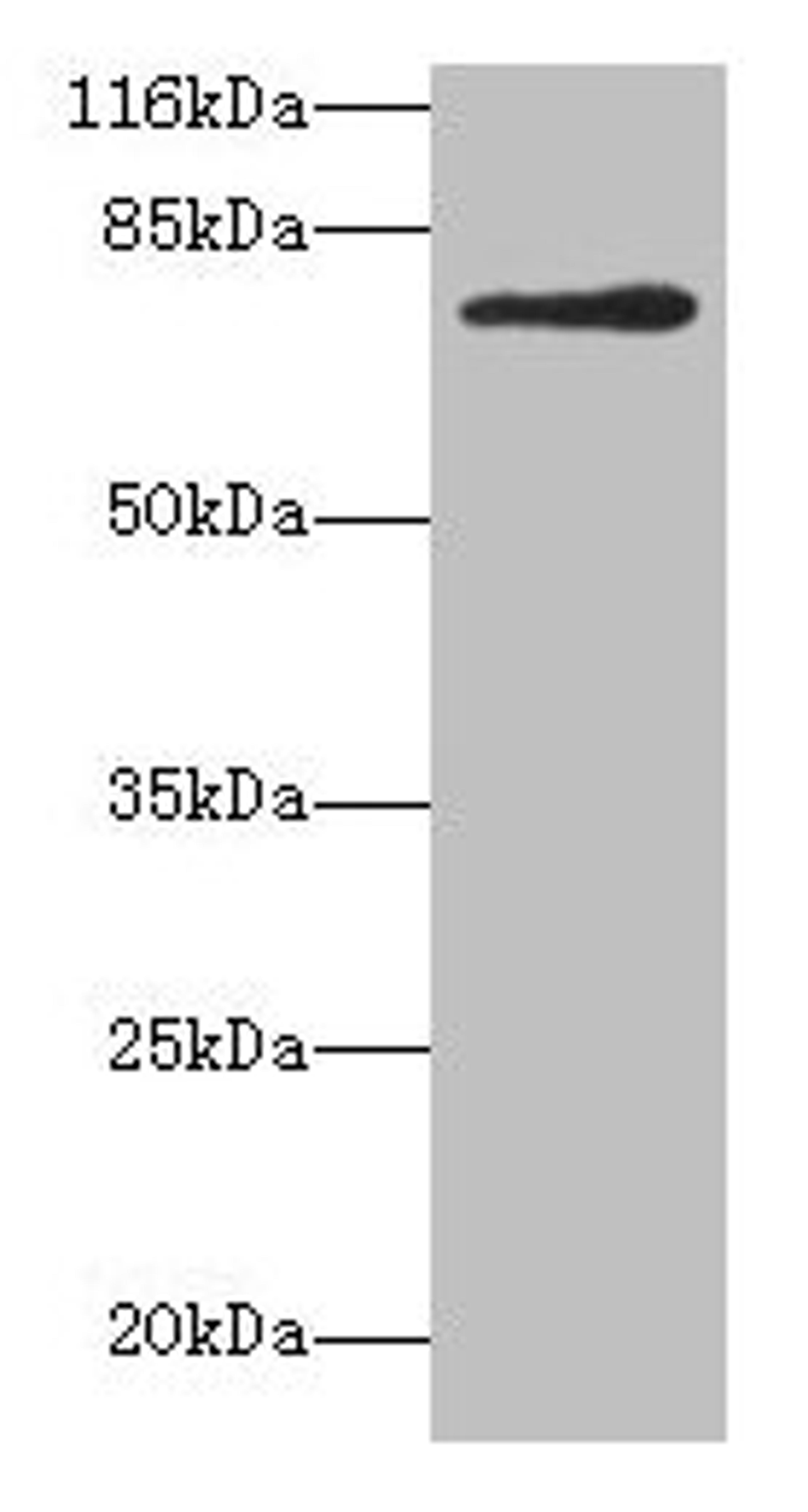 Western blot. All lanes: MTHFR antibody at 2µg/ml + 293T whole cell lysate. Secondary. Goat polyclonal to rabbit IgG at 1/10000 dilution. Predicted band size: 75, 79 kDa. Observed band size: 75 kDa