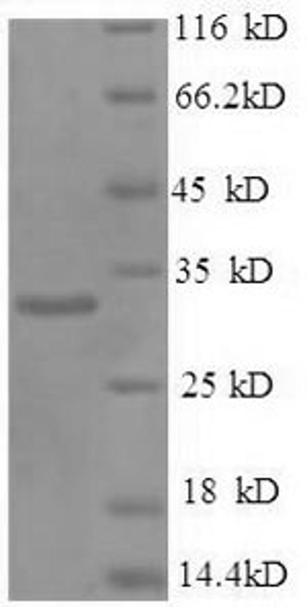 (Tris-Glycine gel) Discontinuous SDS-PAGE (reduced) with 5% enrichment gel and 15% separation gel.