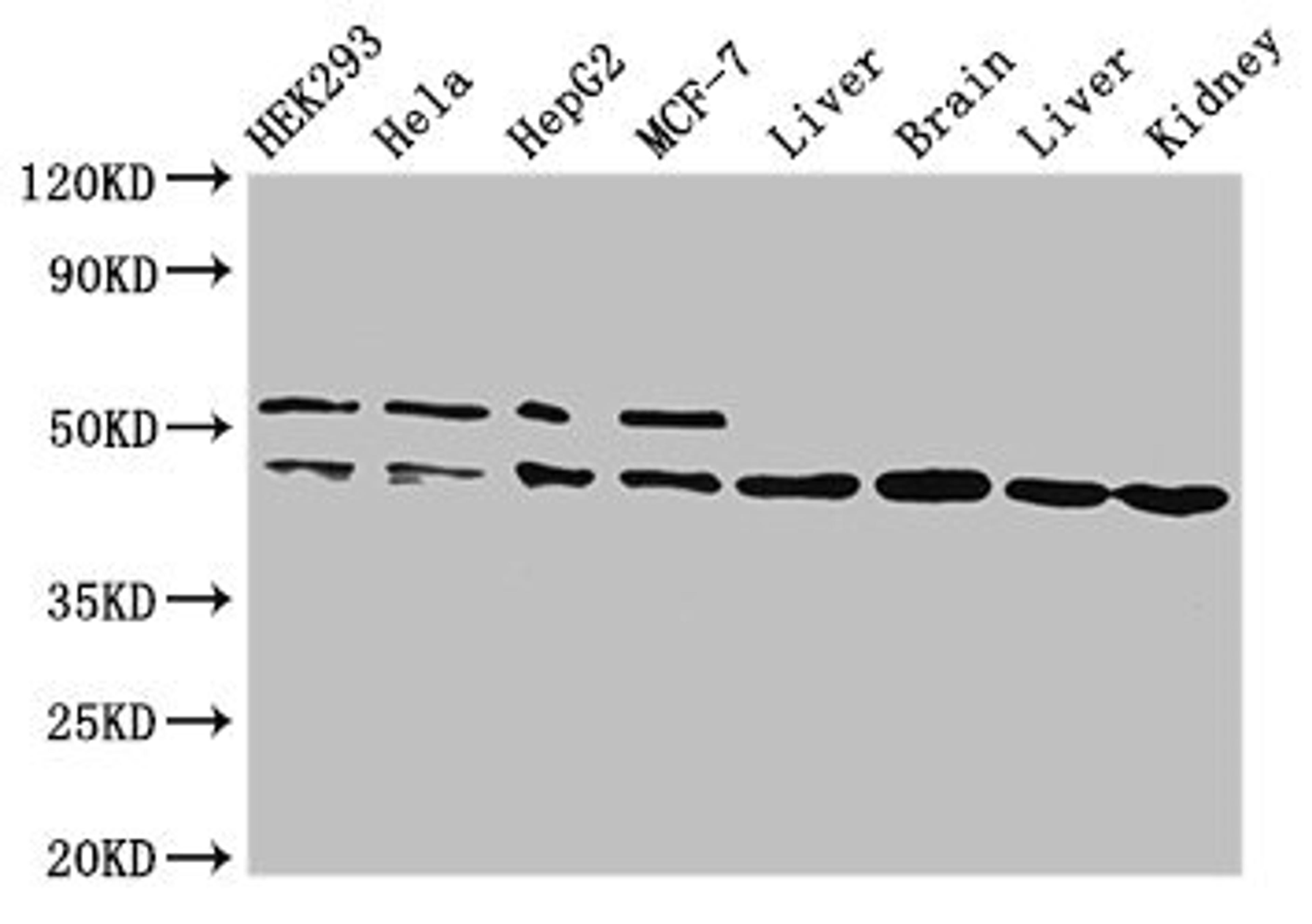 Western Blot. Positive WB detected in: HEK293 whole cell lysate, Hela whole cell lysate, HepG2 whole cell lysate, MCF-7 whole cell lysate, Rat liver tissue, Mouse brain tissue, Mouse liver tissue, Mouse kidney tissue. All lanes: IDH1 antibody at 2ug/ml. Secondary. Goat polyclonal to rabbit IgG at 1/50000 dilution. Predicted band size: 47 kDa. Observed band size: 47, 52 kDa. 