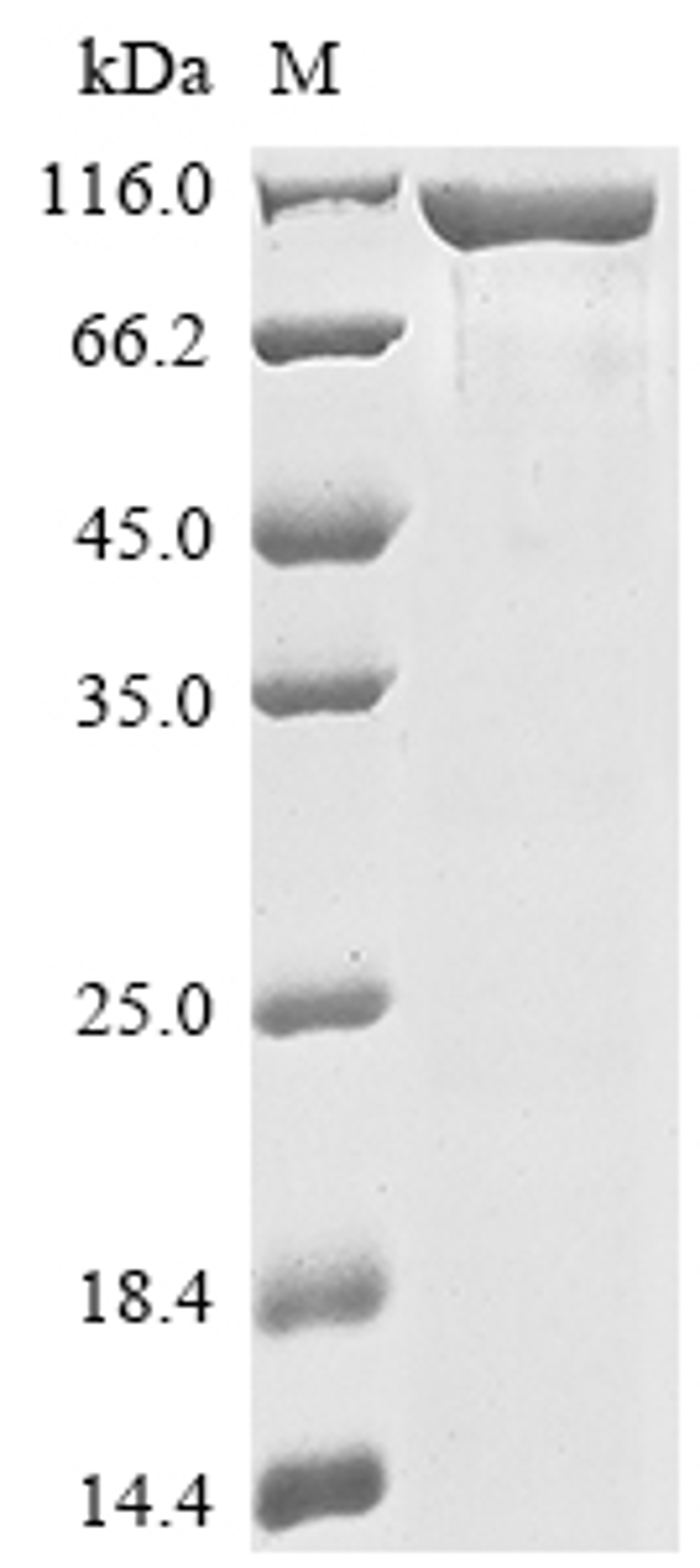 (Tris-Glycine gel) Discontinuous SDS-PAGE (reduced) with 5% enrichment gel and 15% separation gel.