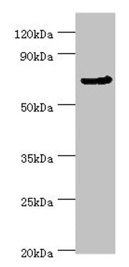 Western blot. All lanes: CDC16 antibody at 4µg/ml + Jurkat whole cell lysate. Secondary. Goat polyclonal to rabbit IgG at 1/10000 dilution. Predicted band size: 72, 66, 61 kDa. Observed band size: 72 kDa