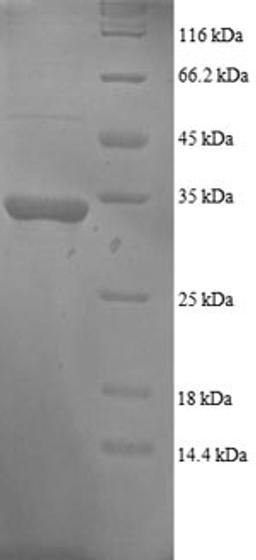 (Tris-Glycine gel) Discontinuous SDS-PAGE (reduced) with 5% enrichment gel and 15% separation gel.