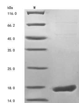 (Tris-Glycine gel) Discontinuous SDS-PAGE (reduced) with 5% enrichment gel and 15% separation gel.