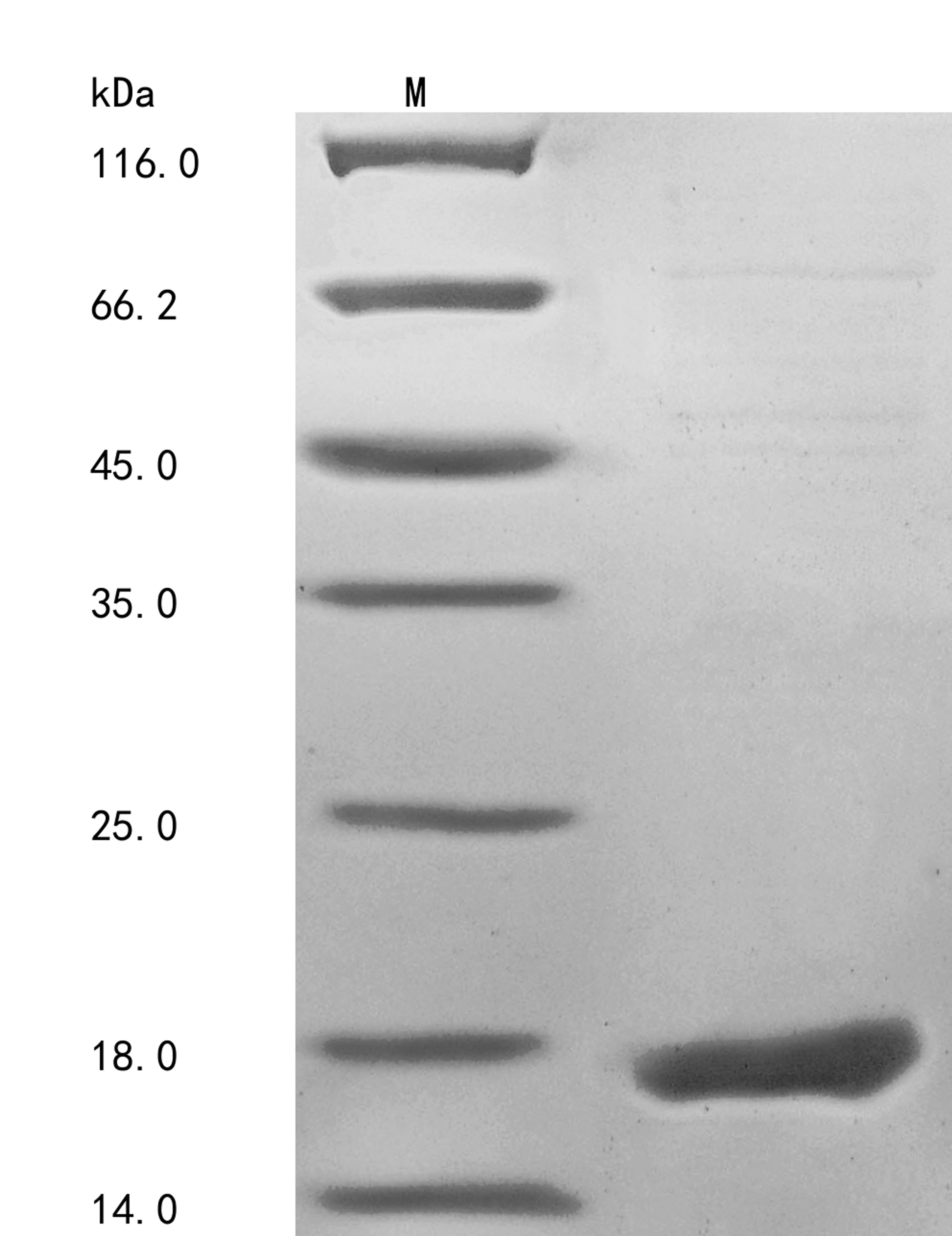 (Tris-Glycine gel) Discontinuous SDS-PAGE (reduced) with 5% enrichment gel and 15% separation gel.