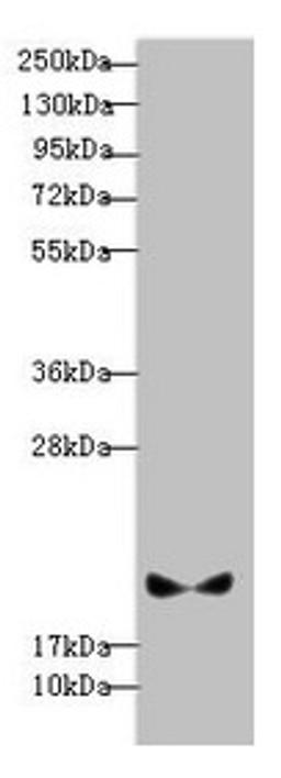 Western blot. All lanes: BLOC1S6 antibody at 3.13µg/ml + A431 whole cell lysate. Secondary. Goat polyclonal to rabbit IgG at 1/10000 dilution. Predicted band size: 20, 9 kDa. Observed band size: 20 kDa