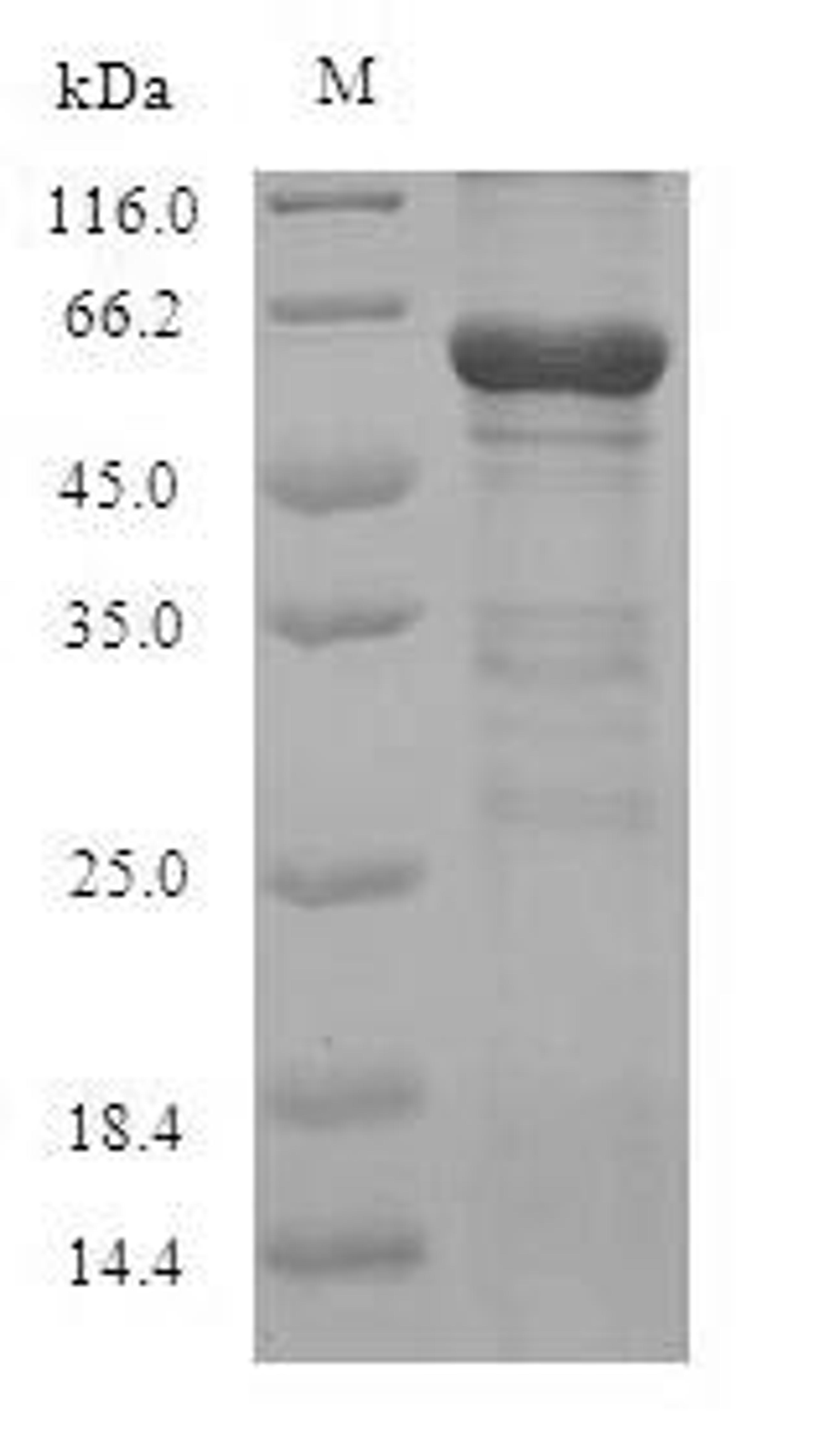 (Tris-Glycine gel) Discontinuous SDS-PAGE (reduced) with 5% enrichment gel and 15% separation gel.