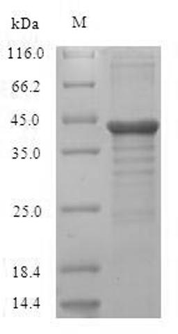 (Tris-Glycine gel) Discontinuous SDS-PAGE (reduced) with 5% enrichment gel and 15% separation gel.
