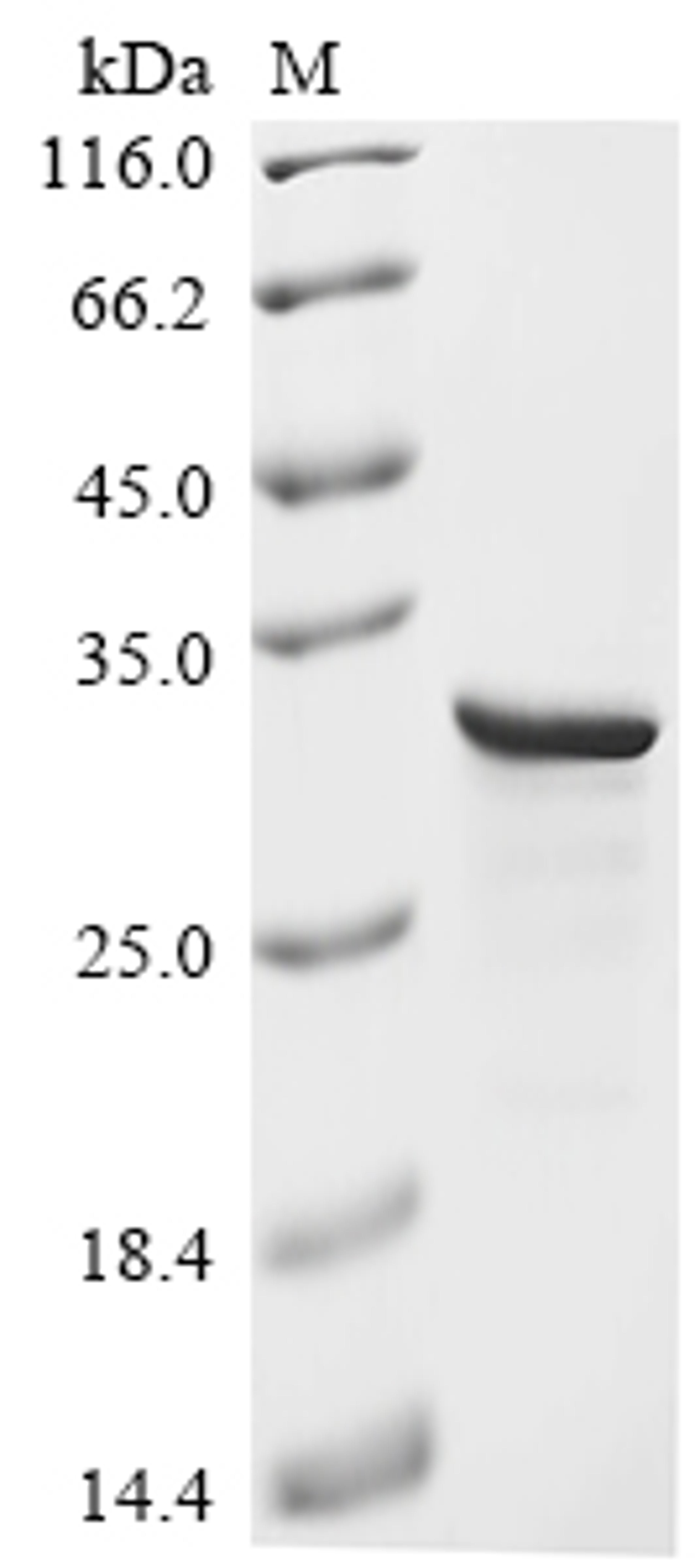 (Tris-Glycine gel) Discontinuous SDS-PAGE (reduced) with 5% enrichment gel and 15% separation gel.