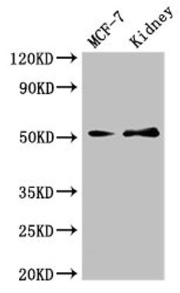 Western Blot. Positive WB detected in: MCF-7 whole cell lysate, Mouse kidney tissue. All lanes: GFRA1 antibody at 3µg/ml. Secondary. Goat polyclonal to rabbit IgG at 1/50000 dilution. Predicted band size: 52, 51 kDa. Observed band size: 52 kDa