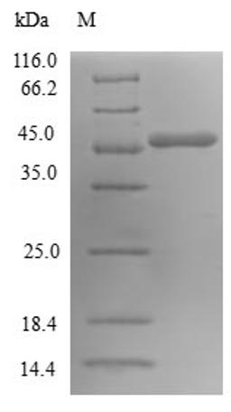 (Tris-Glycine gel) Discontinuous SDS-PAGE (reduced) with 5% enrichment gel and 15% separation gel.