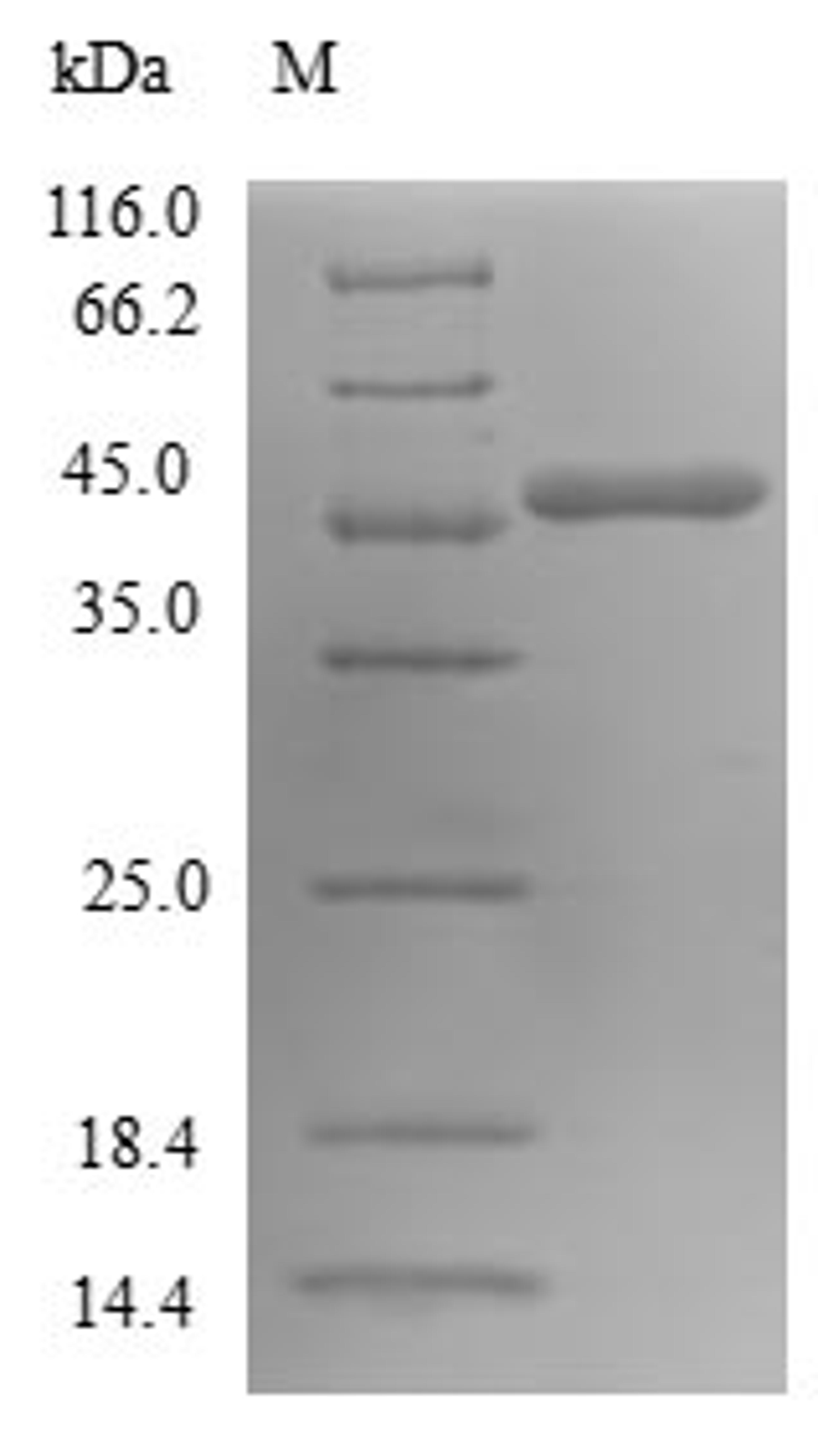 (Tris-Glycine gel) Discontinuous SDS-PAGE (reduced) with 5% enrichment gel and 15% separation gel.