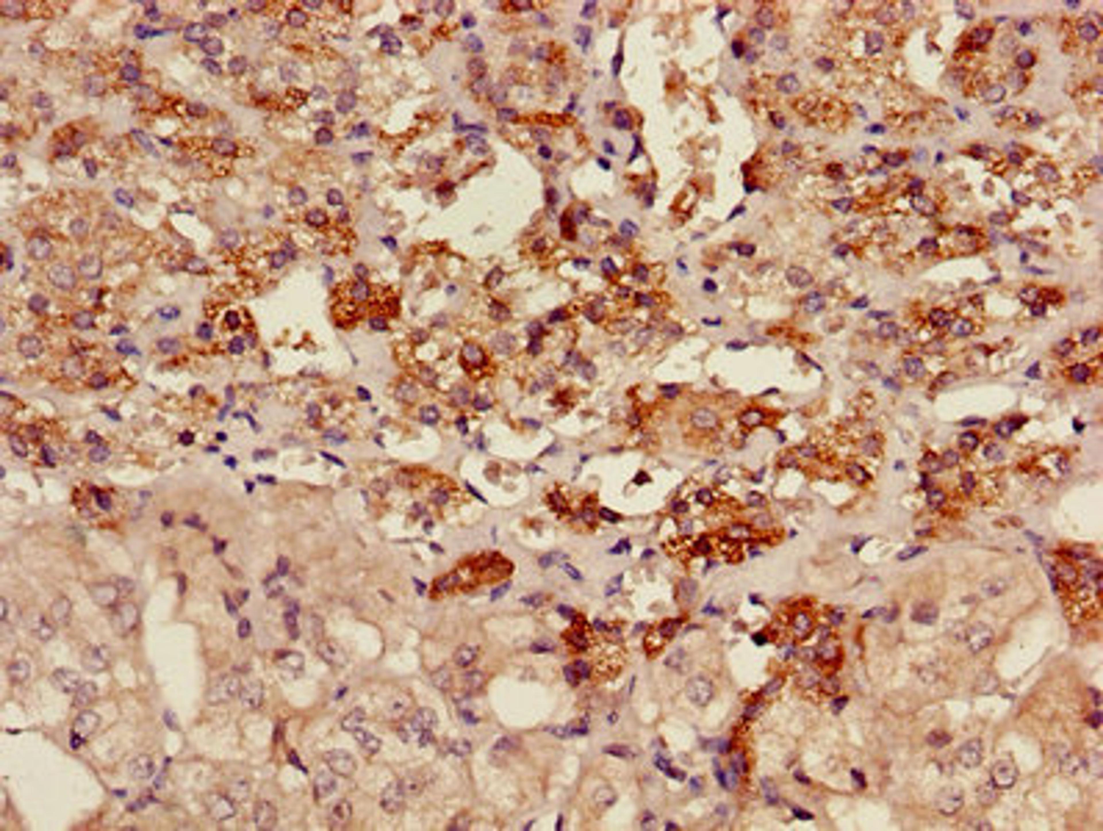 Immunohistochemistry of paraffin-embedded human adrenal gland tissue using CSB-PA001529LA01HU at dilution of 1:100