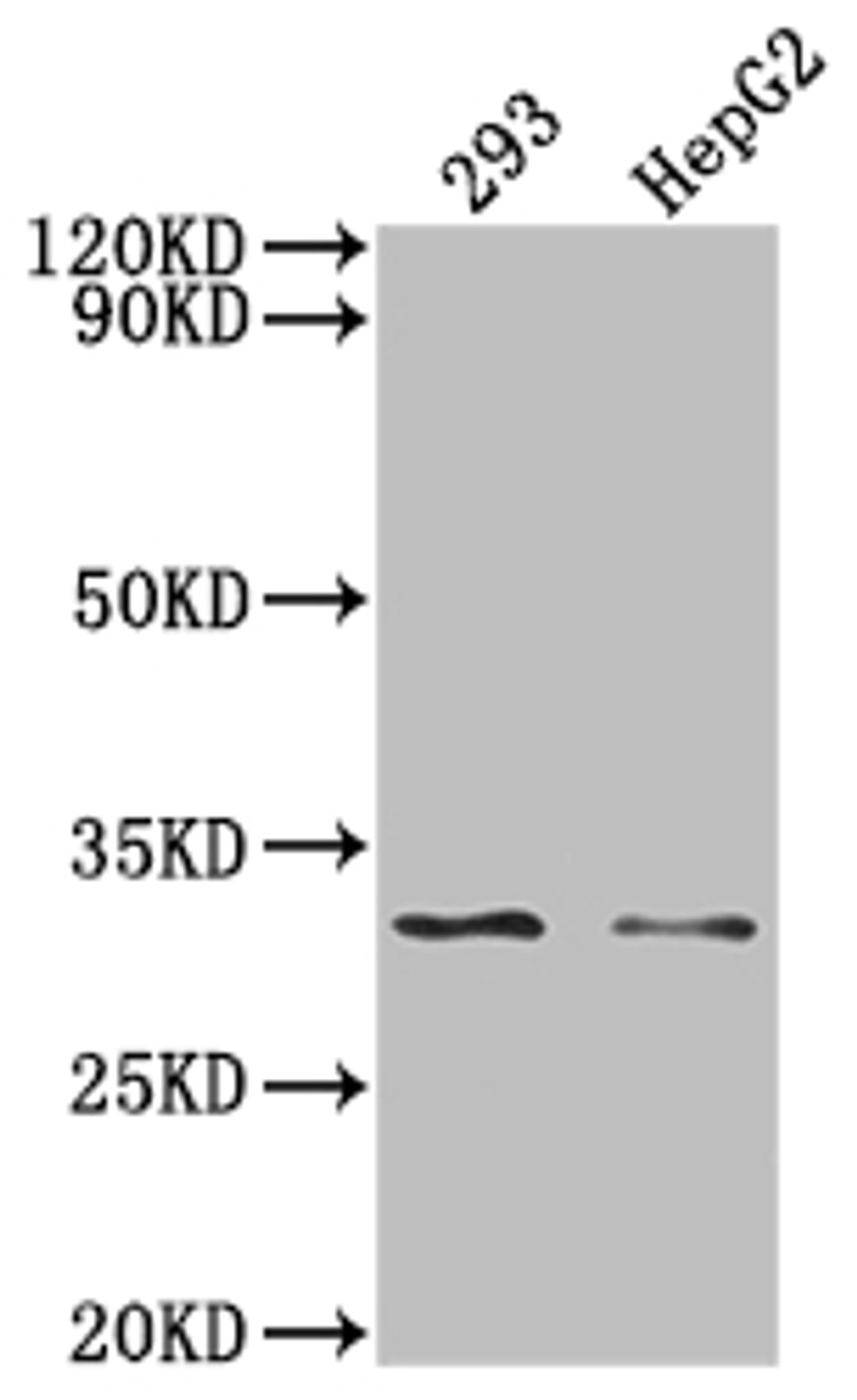 Western Blot. Positive WB detected in: 293 whole cell lysate, HepG2 whole cell lysate, . All lanes: NDUFS3 antibody at 1:2000. Secondary. Goat polyclonal to rabbit IgG at 1/50000 dilution. Predicted band size: 31, 15 KDa. Observed band size: 31 kDa. 