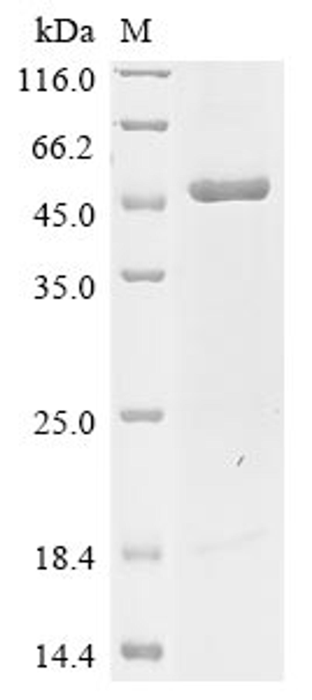 (Tris-Glycine gel) Discontinuous SDS-PAGE (reduced) with 5% enrichment gel and 15% separation gel.