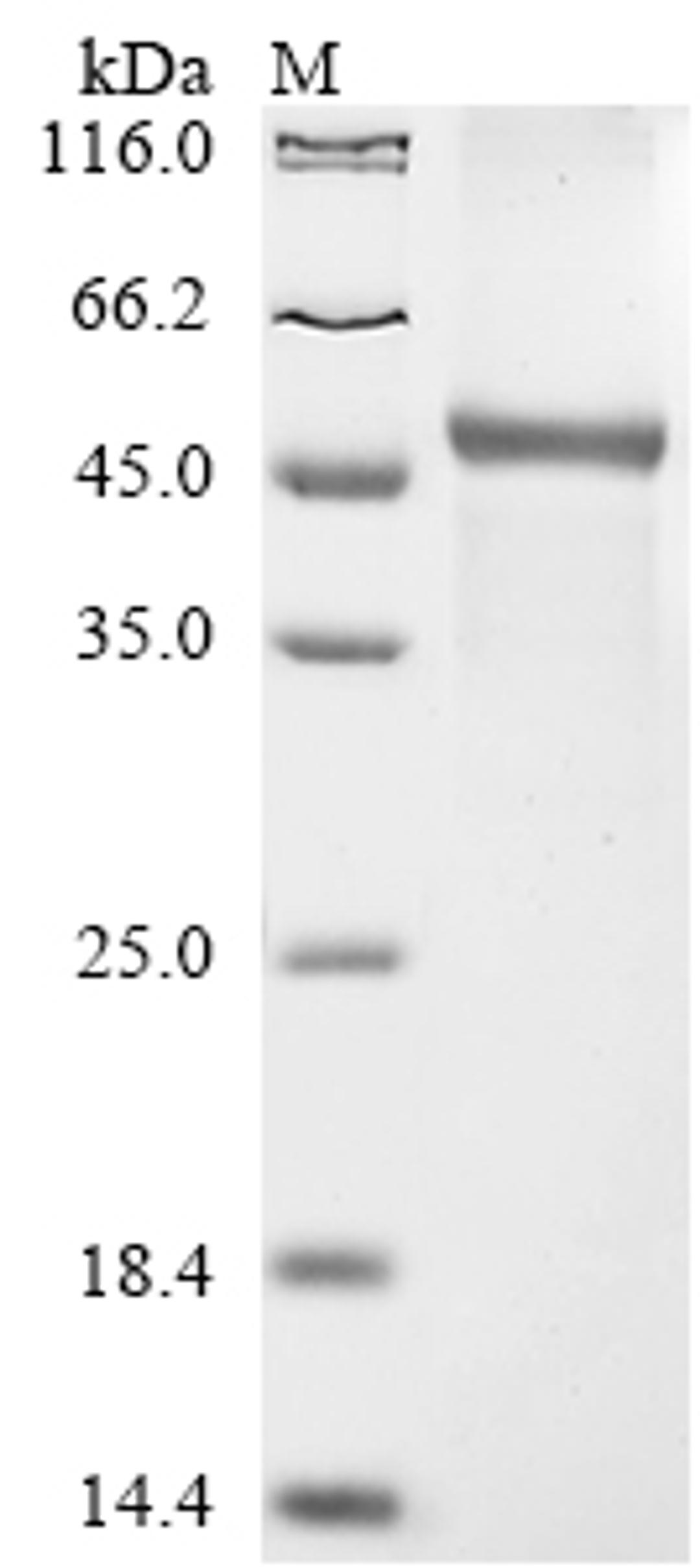 (Tris-Glycine gel) Discontinuous SDS-PAGE (reduced) with 5% enrichment gel and 15% separation gel.