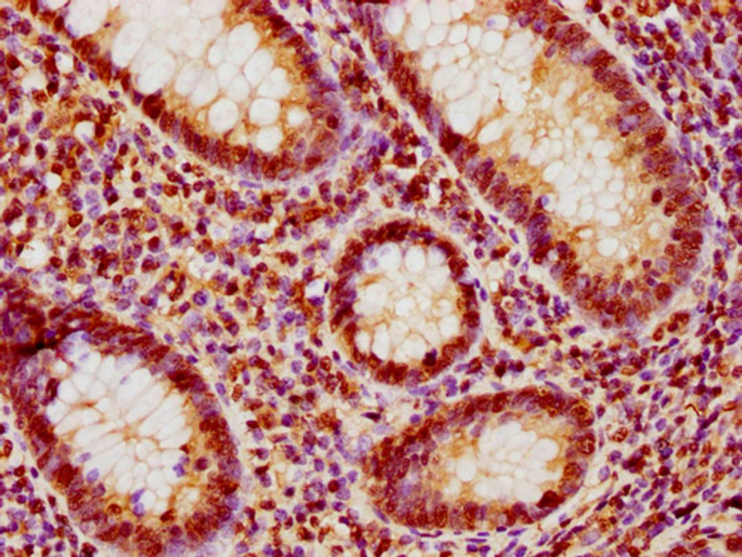 IHC image of CSB-PA010377OA188nphHU diluted at 1:10 and staining in paraffin-embedded human appendix tissue performed on a Leica BondTM system. After dewaxing and hydration, antigen retrieval was mediated by high pressure in a citrate buffer (pH 6.0). Section was blocked with 10% normal goat serum 30min at RT. Then primary antibody (1% BSA) was incubated at 4°C overnight. The primary is detected by a biotinylated secondary antibody and visualized using an HRP conjugated SP system.
