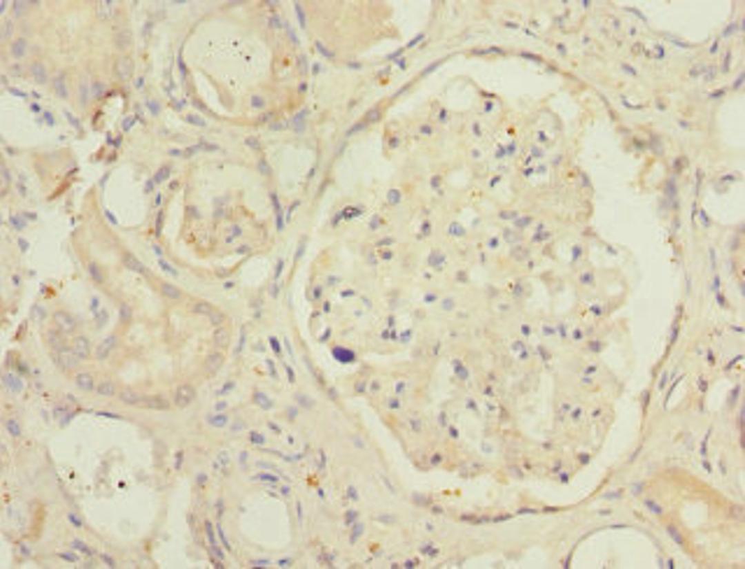 Immunohistochemistry of paraffin-embedded human kidney tissue using CSB-PA887043DSR1HU at dilution of 1:100