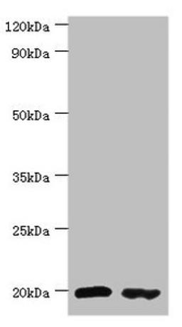 Western blot. All lanes: Peptidyl-tRNA hydrolase 2, mitochondrial antibody at 4ug/ml. Lane 1: MM231 whole cell lysate. Lane 2: Jurkat whole cell lysate. Secondary. Goat polyclonal to rabbit IgG at 1/10000 dilution. Predicted band size: 19 kDa. Observed band size: 19 kDa. 