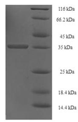 (Tris-Glycine gel) Discontinuous SDS-PAGE (reduced) with 5% enrichment gel and 15% separation gel.