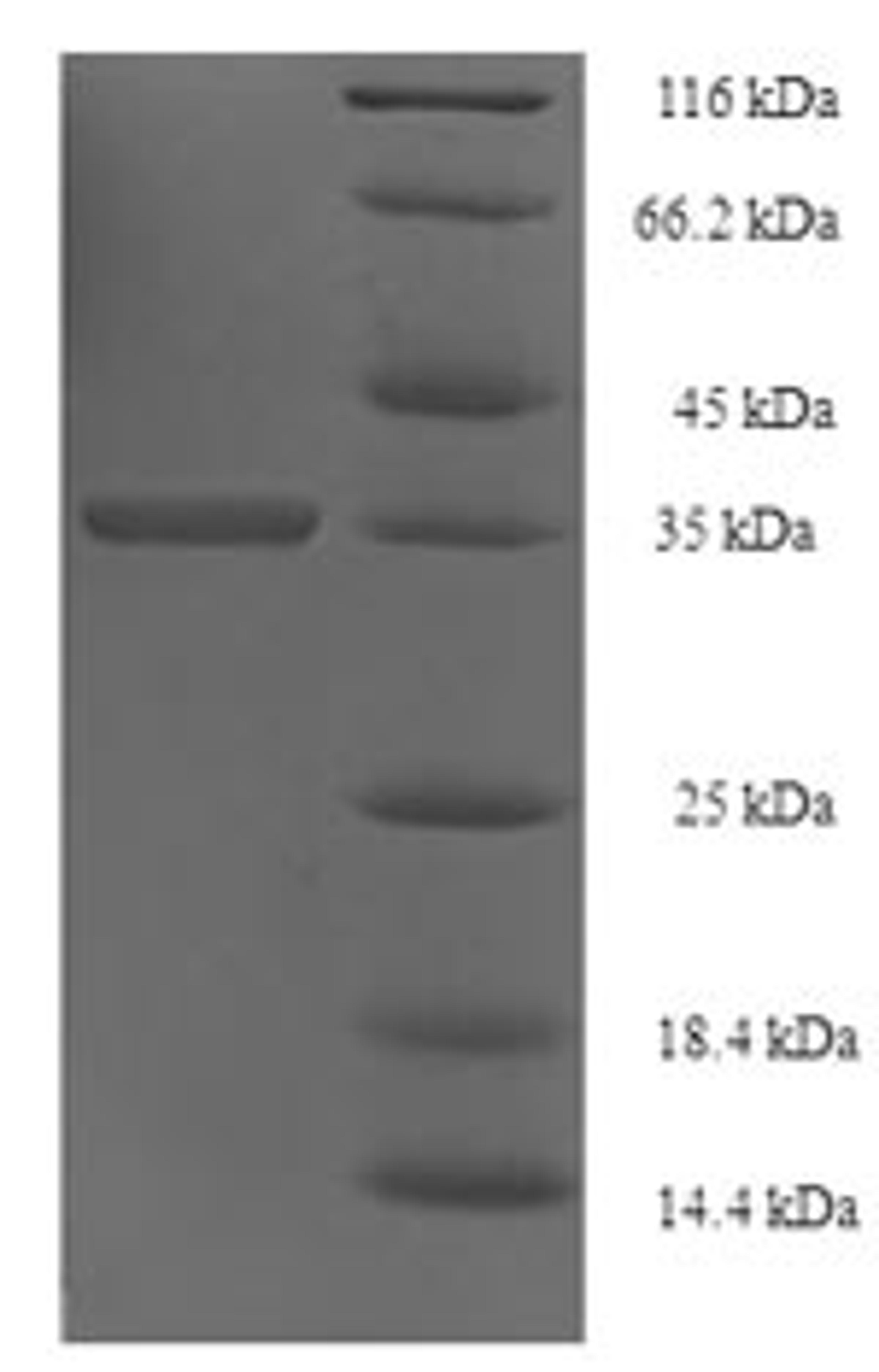 (Tris-Glycine gel) Discontinuous SDS-PAGE (reduced) with 5% enrichment gel and 15% separation gel.