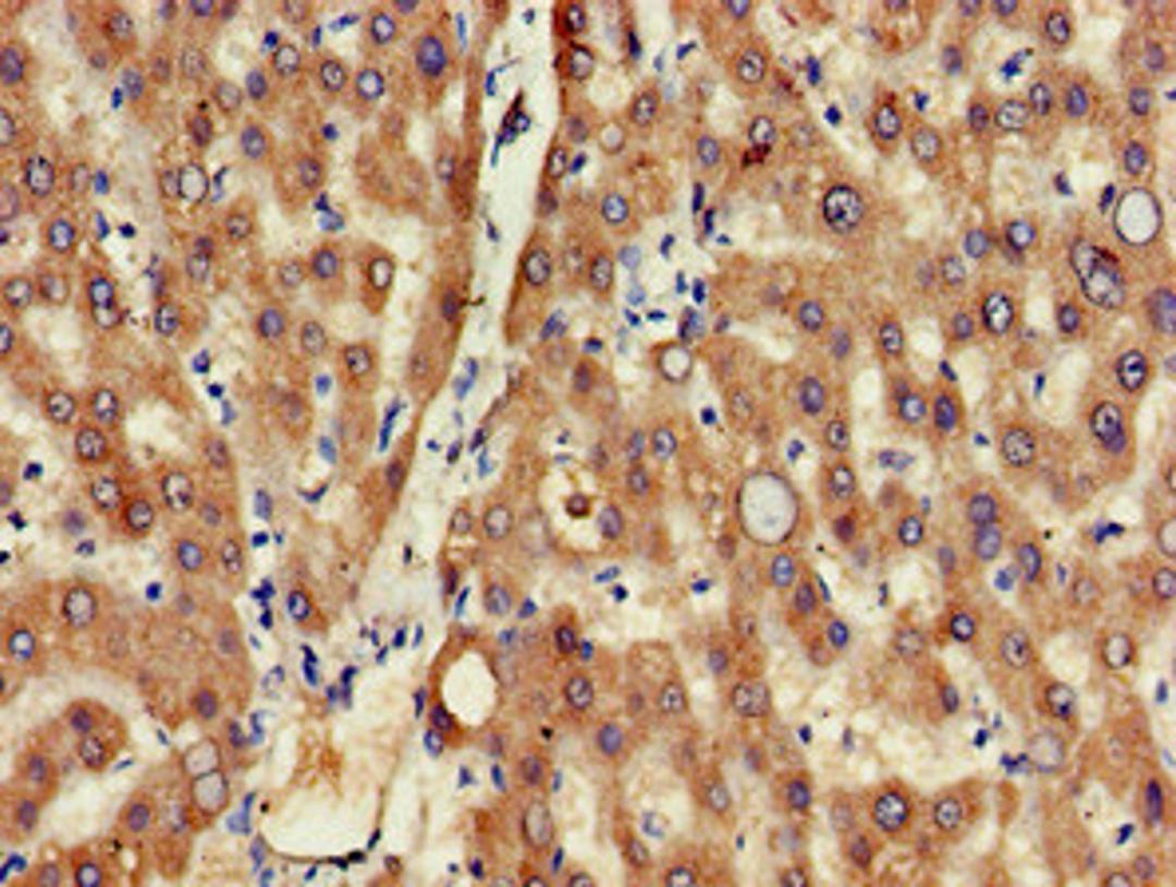 Immunohistochemistry of paraffin-embedded human liver tissue using CSB-PA882163LA01HU at dilution of 1:100