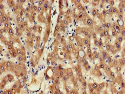 Immunohistochemistry of paraffin-embedded human liver tissue using CSB-PA882163LA01HU at dilution of 1:100