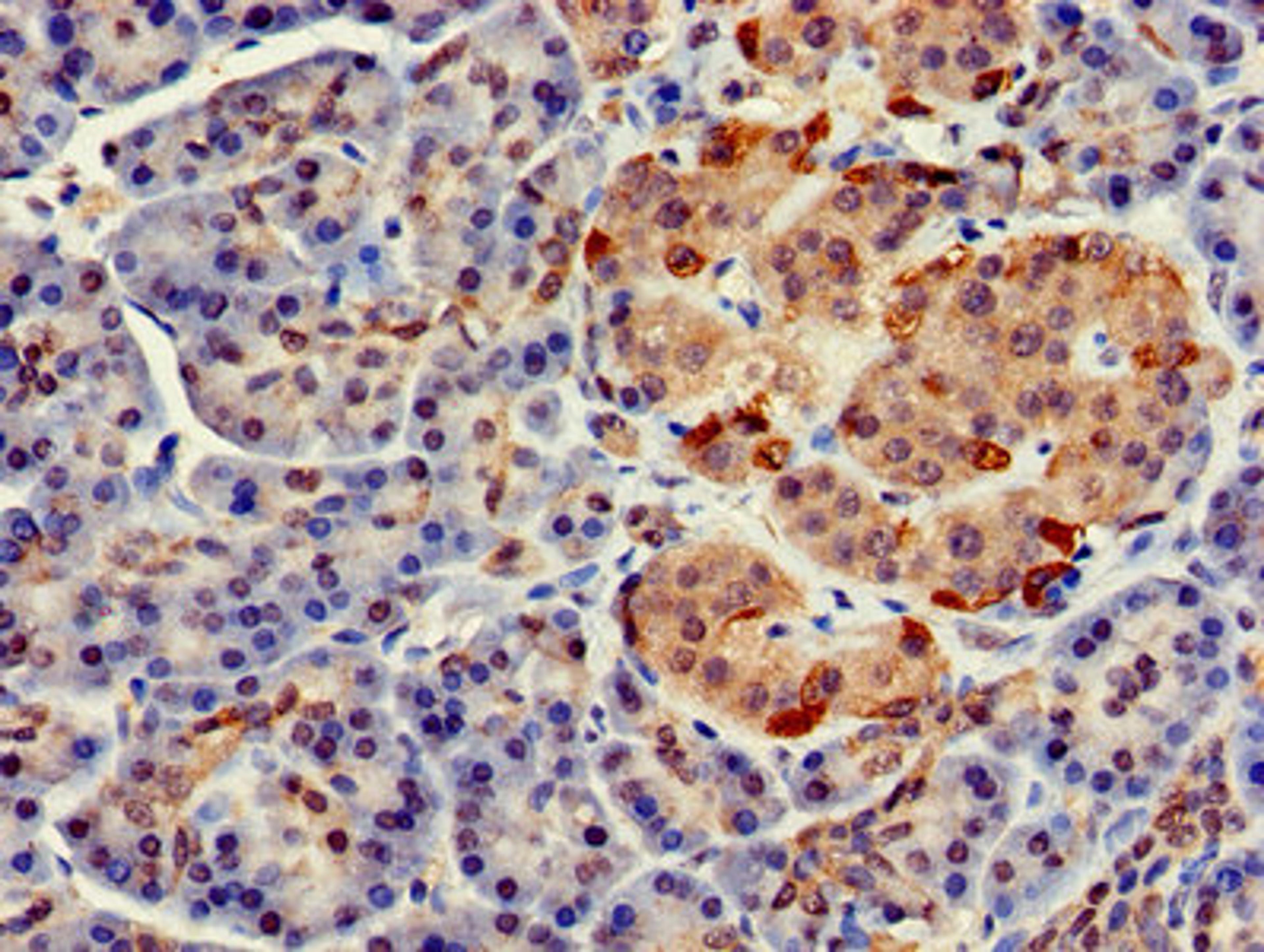 Immunohistochemistry of paraffin-embedded human pancreatic tissue using CSB-PA008428LA01HU at dilution of 1:100