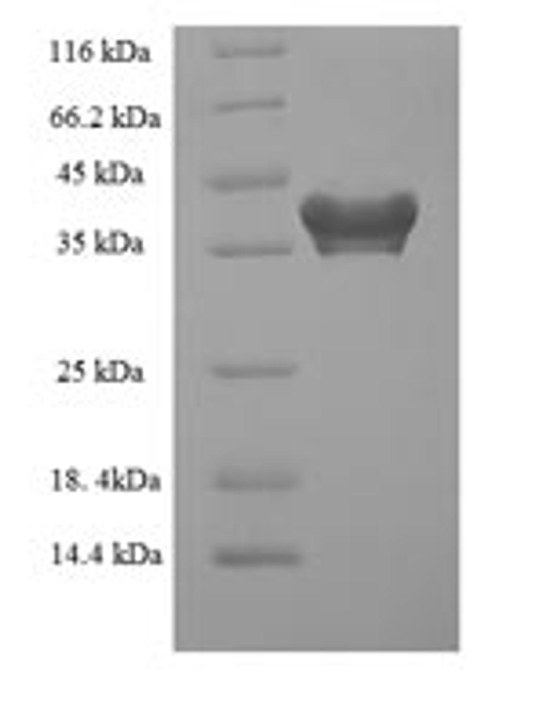 (Tris-Glycine gel) Discontinuous SDS-PAGE (reduced) with 5% enrichment gel and 15% separation gel.