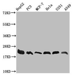 Western Blot. Positive WB detected in: HepG2 whole cell lysate, PC3 whole cell lysate, MCF-7 whole cell lysate, Hela whole cell lysate, U251 whole cell lysate, A549 whole cell lysate. All lanes: FIS1 antibody at 1:1000. Secondary. Goat polyclonal to rabbit IgG at 1/50000 dilution. Predicted band size: 17 kDa. Observed band size: 17-22 kDa. 