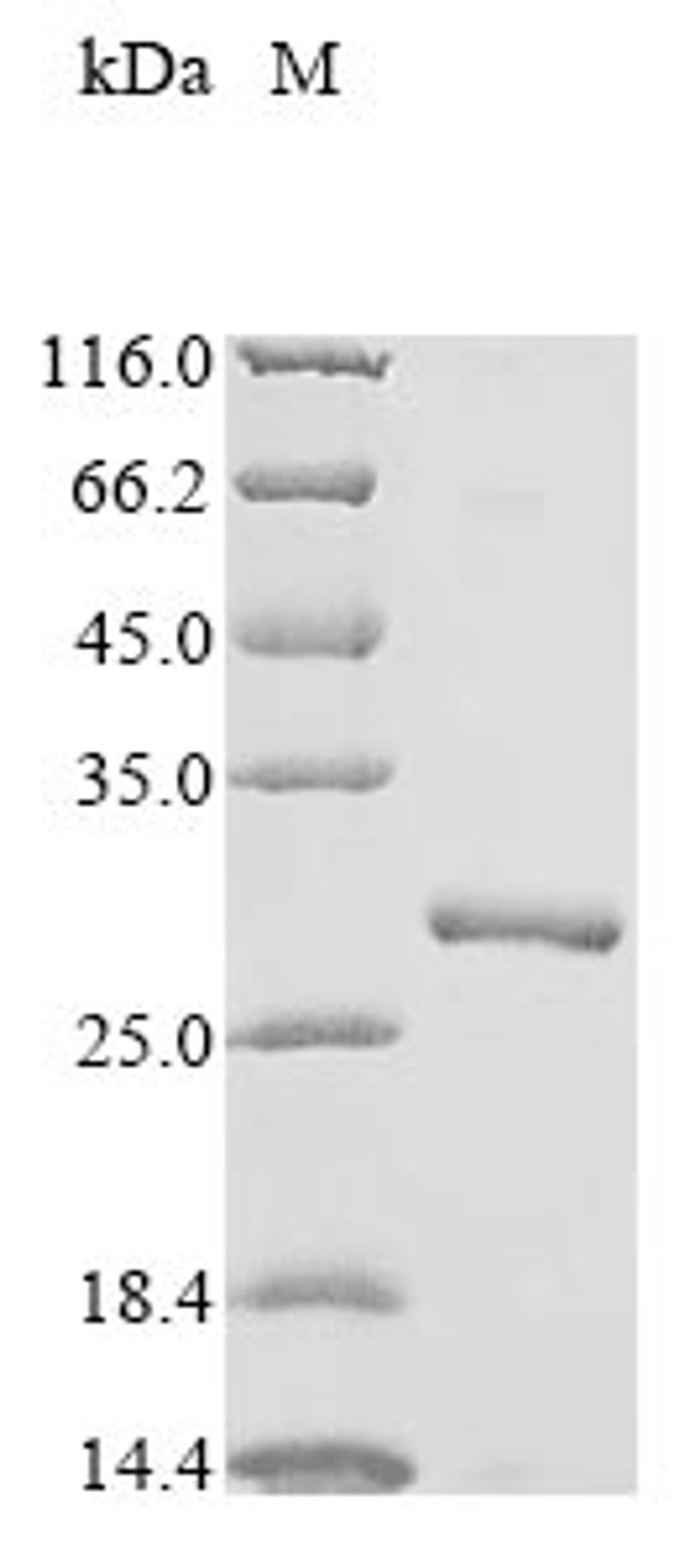 (Tris-Glycine gel) Discontinuous SDS-PAGE (reduced) with 5% enrichment gel and 15% separation gel.