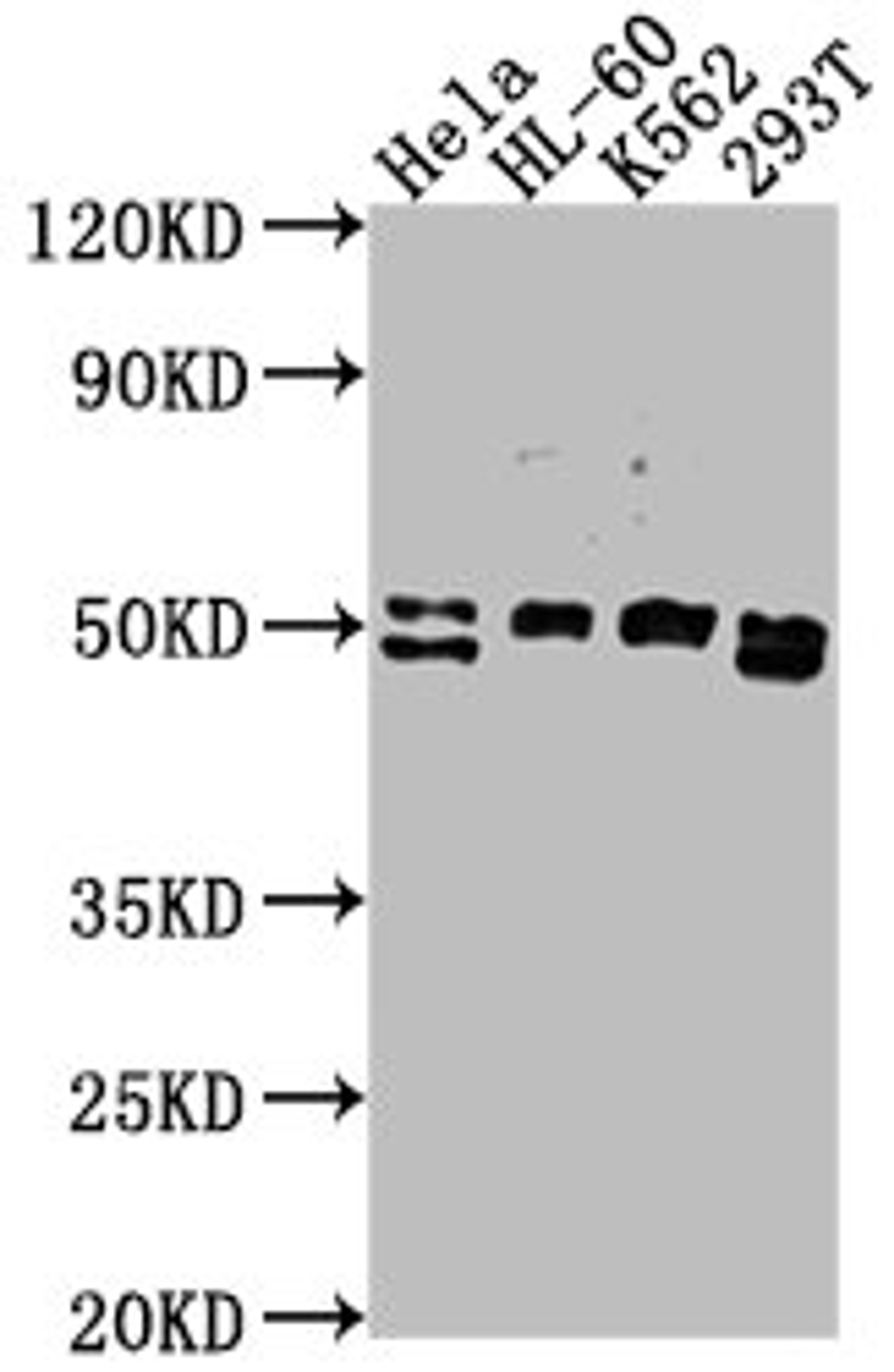 Western Blot. Positive WB detected in: HeLa whole cell lysate, HL-60 whole cell lysate, K562 whole cell lysate, 293T whole cell lysate. All lanes: DDX47 antibody at 1:2000. Secondary. Goat polyclonal to rabbit IgG at 1/50000 dilution. Predicted band size: 51, 46 kDa. Observed band size: 51 kDa. 