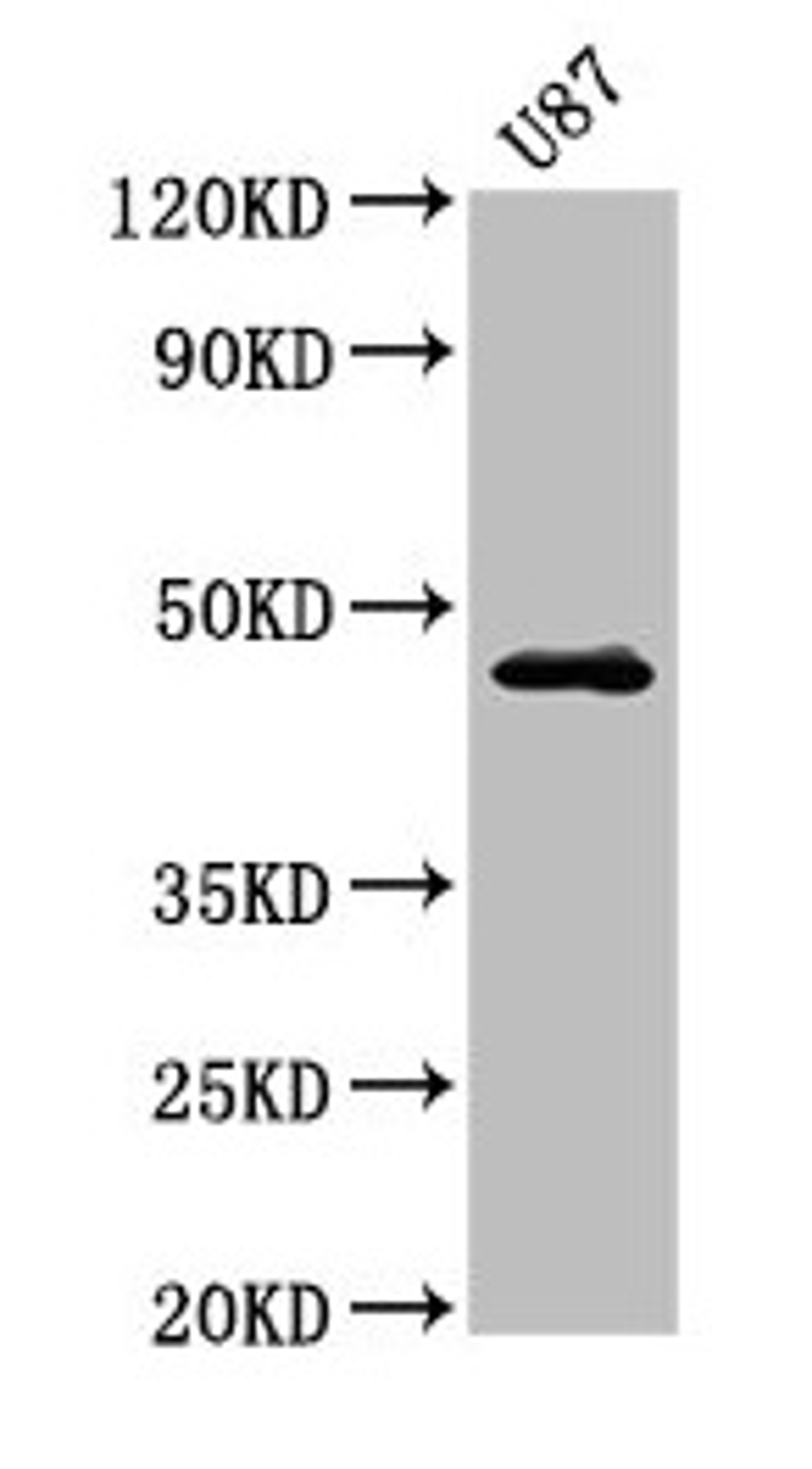 Western Blot. Positive WB detected in: U87 whole cell lysate. All lanes: NTSR2 antibody at 3.2µg/ml. Secondary. Goat polyclonal to rabbit IgG at 1/50000 dilution. Predicted band size: 46 kDa. Observed band size: 46 kDa