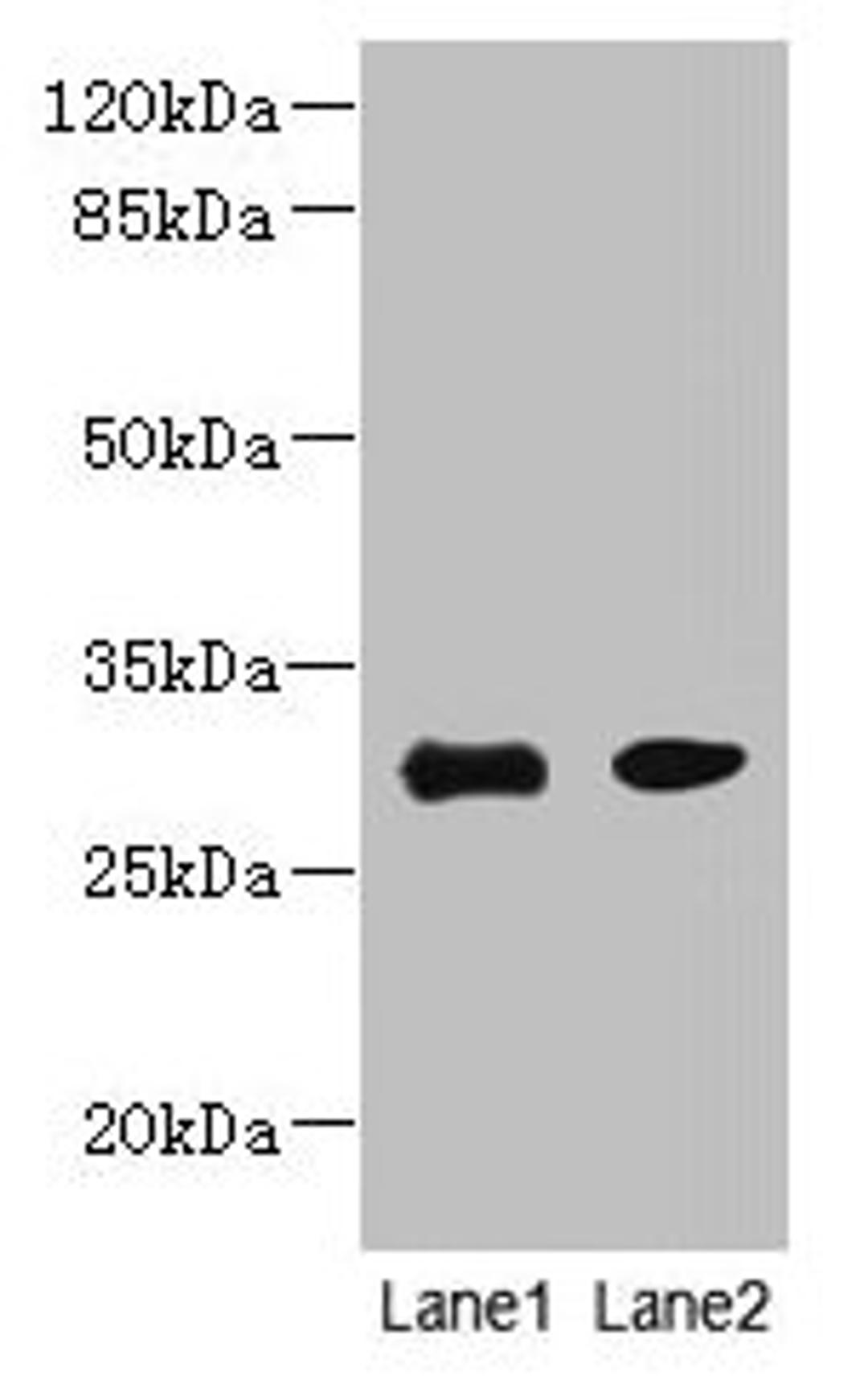 Western blot. All lanes: PI4KAP1 antibody at 10µg/ml. Lane 1: Mouse gonadal tissue. Lane 2: 293T whole cell lysate. Secondary. Goat polyclonal to rabbit IgG at 1/10000 dilution. Predicted band size: 30 kDa. Observed band size: 30 kDa