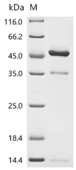 (Tris-Glycine gel) Discontinuous SDS-PAGE (reduced) with 5% enrichment gel and 15% separation gel.