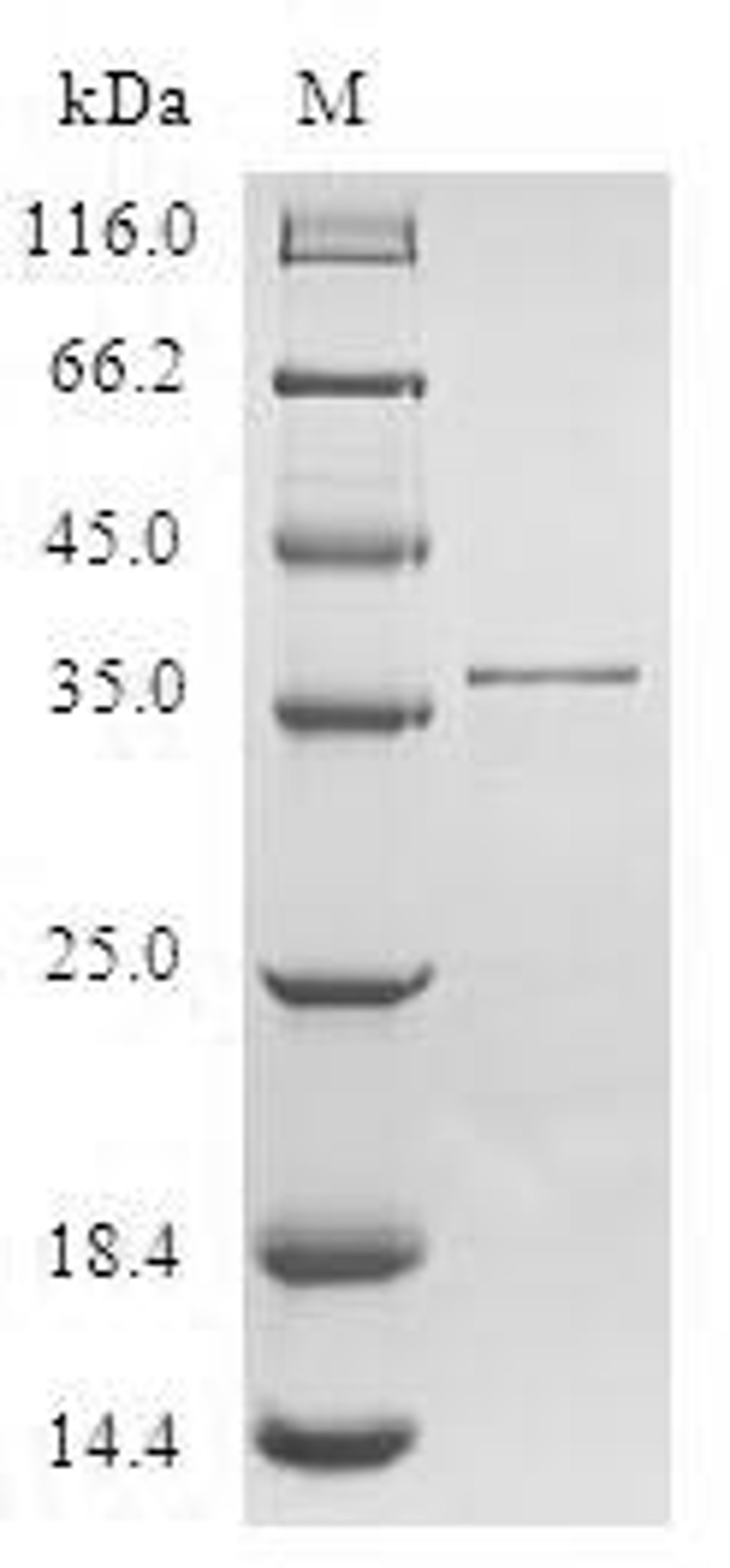 (Tris-Glycine gel) Discontinuous SDS-PAGE (reduced) with 5% enrichment gel and 15% separation gel.
