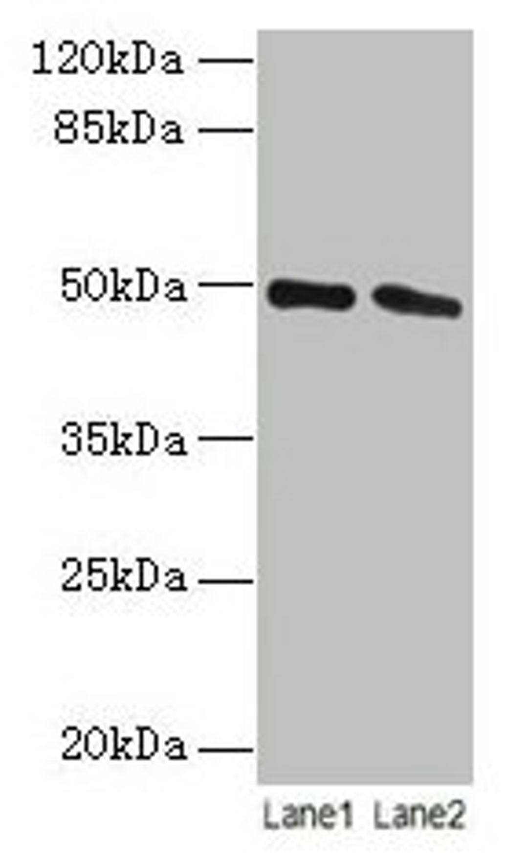 Western blot. All lanes: STAMBP antibody at 12µg/ml. Lane 1: Jurkat whole cell lysate. Lane 2: Hela whole cell lysate. Secondary. Goat polyclonal to rabbit IgG at 1/10000 dilution. Predicted band size: 49, 40 kDa. Observed band size: 49 kDa