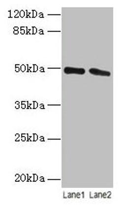 Western blot. All lanes: STAMBP antibody at 12µg/ml. Lane 1: Jurkat whole cell lysate. Lane 2: Hela whole cell lysate. Secondary. Goat polyclonal to rabbit IgG at 1/10000 dilution. Predicted band size: 49, 40 kDa. Observed band size: 49 kDa