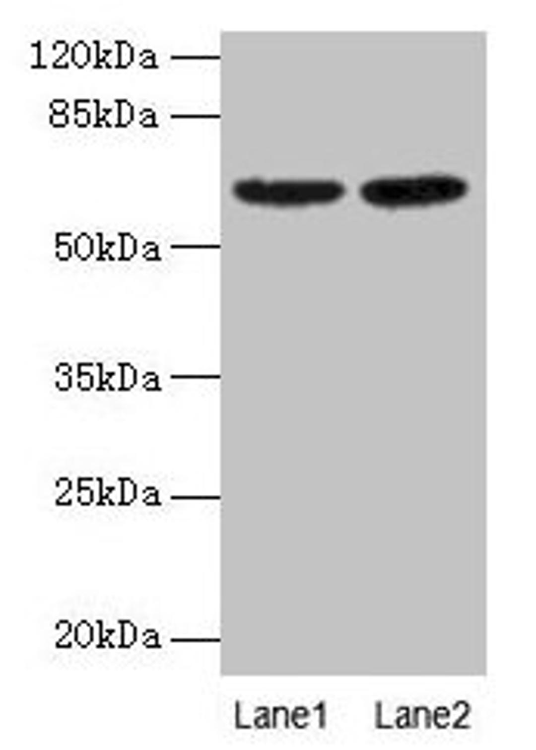 Western Blot. All lanes: NELFB antibody at 2µg/ml. Lane 1: NIH/3T3 whole cell lysate. Lane 2: HL60 whole cell lysate. Secondary. Goat polyclonal to rabbit IgG at 1/15000 dilution. Predicted band size: 66 kDa. Observed band size: 66 kDa