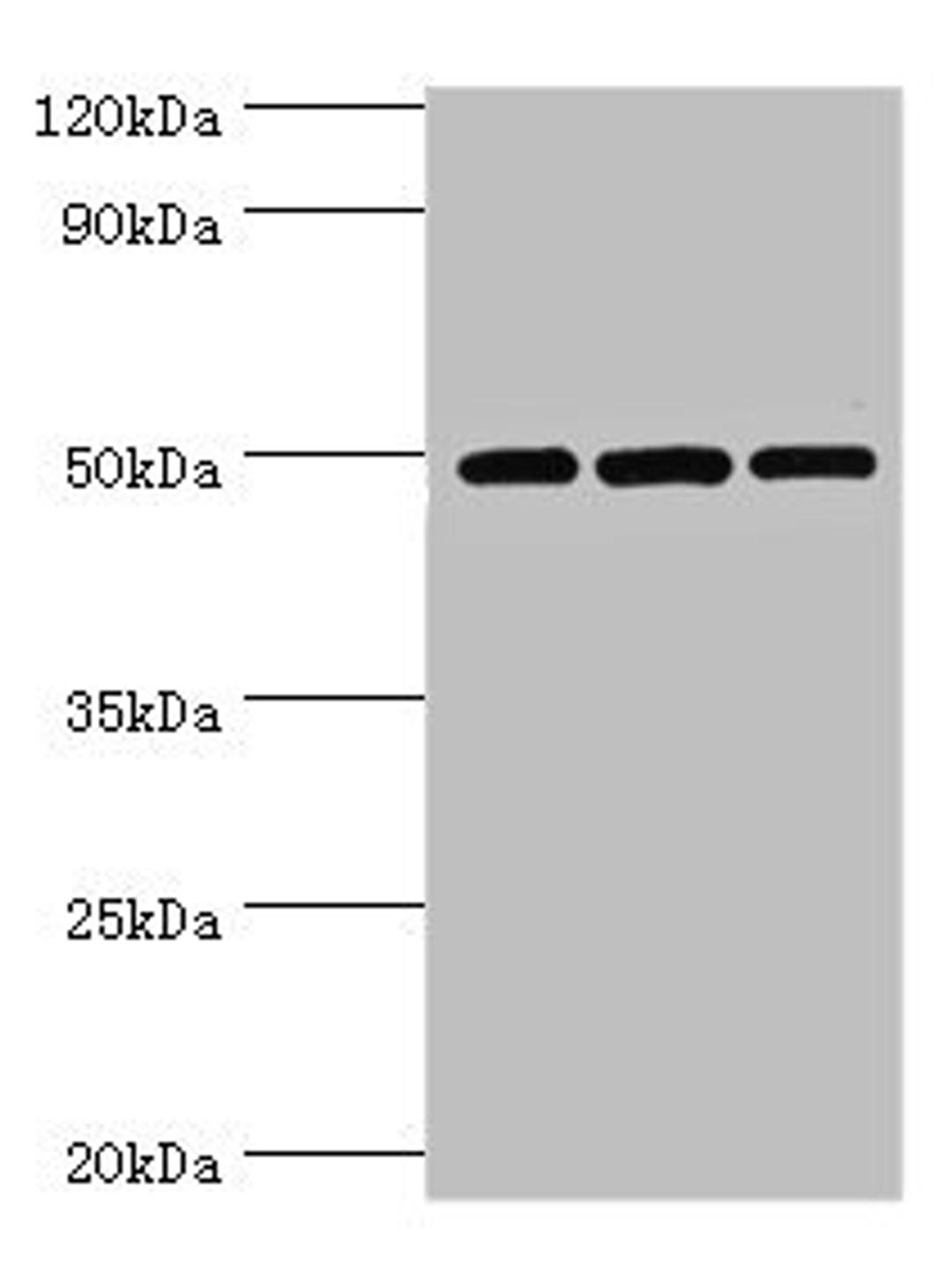 Western blot. All lanes: m7GpppN-mRNA hydrolase antibody at 7ug/ml. Lane 1: Hela whole cell lysate. Lane 2: Jurkat whole cell lysate. Lane 3: 293T whole cell lysate. Secondary. Goat polyclonal to rabbit IgG at 1/10000 dilution. Predicted band size: 49, 45 kDa. Observed band size: 49 kDa. 