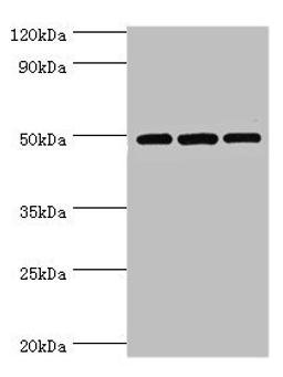 Western blot. All lanes: m7GpppN-mRNA hydrolase antibody at 7ug/ml. Lane 1: Hela whole cell lysate. Lane 2: Jurkat whole cell lysate. Lane 3: 293T whole cell lysate. Secondary. Goat polyclonal to rabbit IgG at 1/10000 dilution. Predicted band size: 49, 45 kDa. Observed band size: 49 kDa. 